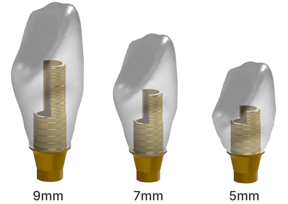 The dental technician then finalizes the restoration design.