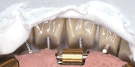 Removable Prosthetic Specialty